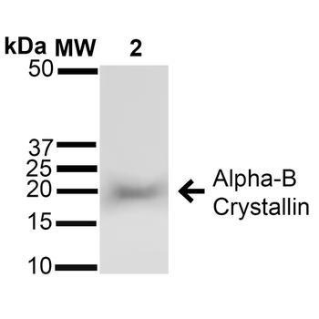 Alpha B Crystallin Antibody (Biotin)