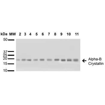 Alpha B Crystallin Antibody (RPE)