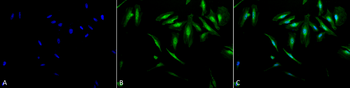 Alpha B Crystallin Antibody (RPE)