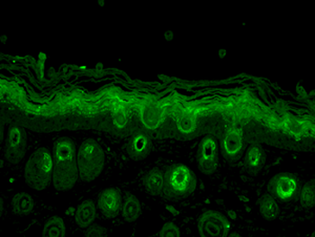 Rab5 Antibody (RPE)