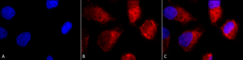 TNF-R1 Antibody (FITC)