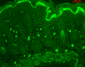 TNF-R1 Antibody (RPE)
