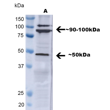 TNF-R1 Antibody (RPE)
