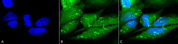 p38 Antibody (RPE)