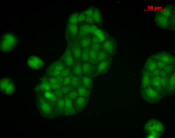 Calnexin-CT Antibody (RPE)