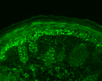 Cpn10 Antibody (Biotin)