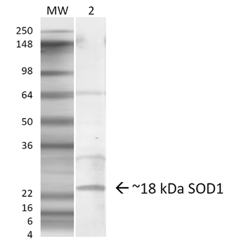 SOD1 (EDI) Antibody (HRP)