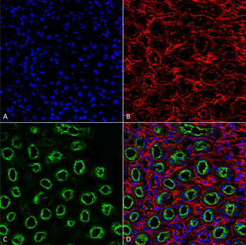 NKCC2 Antibody (RPE)