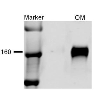 NKCC2 Antibody (RPE)