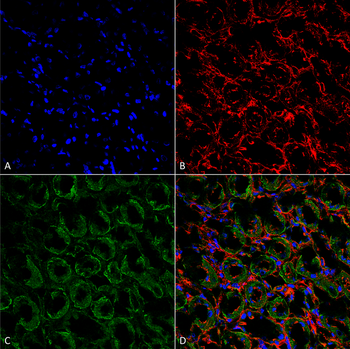 ENaC alpha Antibody (APC)