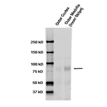 ENaC alpha Antibody (HRP)