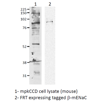 ENaC beta Antibody (Biotin)