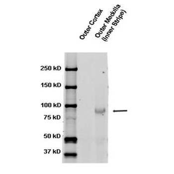 ENaC beta Antibody (PerCP)