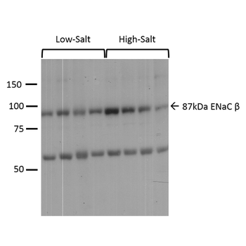 ENaC beta Antibody (RPE)