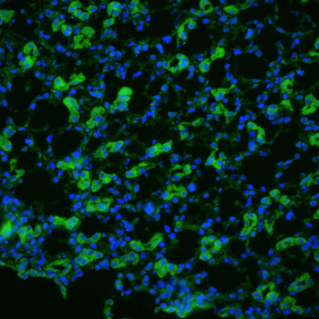 Aquaporin 1 Antibody (APC)