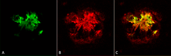 Amyloid Oligomers (A11) Antibody (RPE)