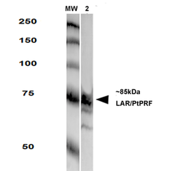 LAR Antibody (HRP)
