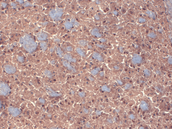 GABA A Receptor Antibody (FITC)