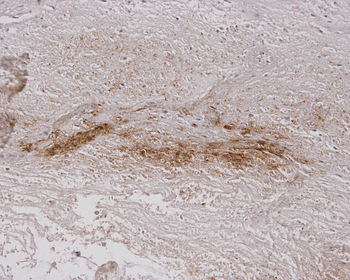 Alginate Antibody (PerCP)