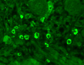GABA A Receptor Antibody (Biotin)