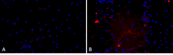 Alpha Synuclein A53T Mutant Pre-formed Fibrils