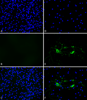 Alpha Synuclein Pre-formed Fibrils