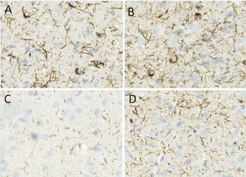 Alpha Synuclein Pre-formed Fibrils
