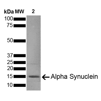 Alpha Synuclein Pre-formed Fibrils