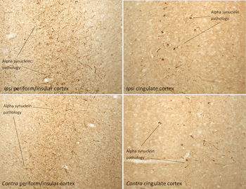 Alpha Synuclein Pre-formed Fibrils