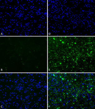 Alpha Synuclein Pre-formed Fibrils