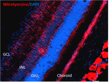 Nitrotyrosine Antibody