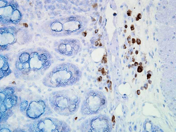 HSP90 Antibody