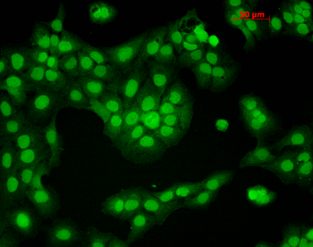 CaMKII Antibody