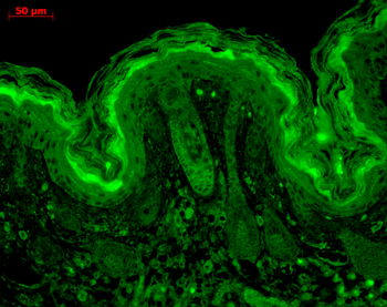 CaMKII Antibody