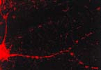 CaMKII Antibody