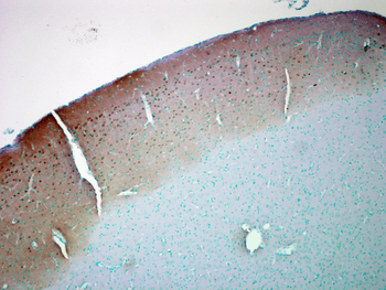 CaMKII Antibody