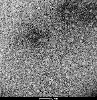 Alpha Synuclein Oligomers