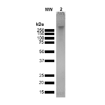 Alpha Synuclein Oligomers