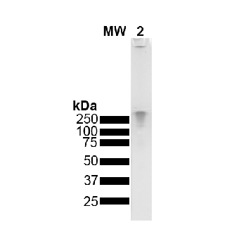 Alpha Synuclein Oligomers