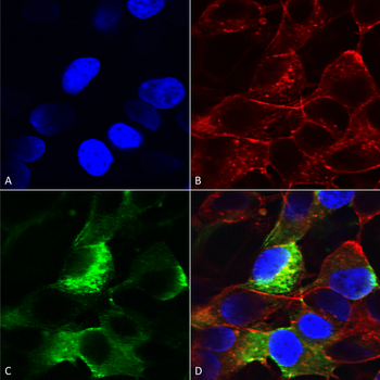 NaVbeta3 Antibody