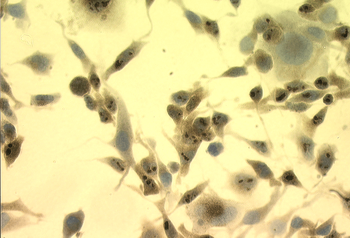 HSP70 Antibody (FITC)