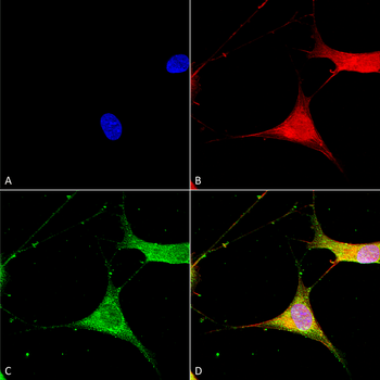 Kir6.1 Antibody (Biotin)