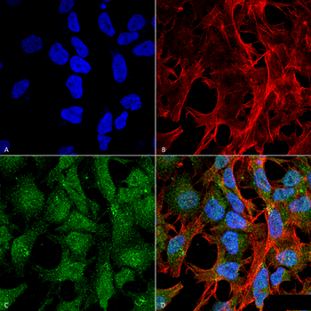 UVRAG Antibody (HRP)