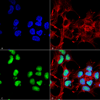Choline Acetyltransferase Antibody (FITC)