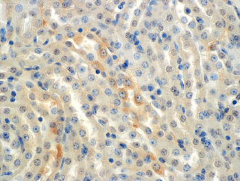 ENaC alpha Antibody (HRP)