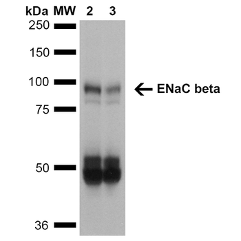 ENaC beta Antibody (FITC)