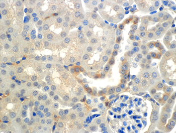 ENaC beta Antibody (PerCP)