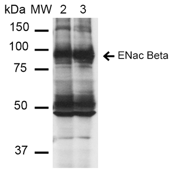 ENaC beta Antibody (RPE)