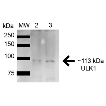 ULK1 Antibody