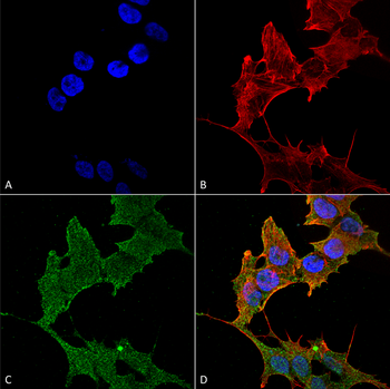 ULK1 Antibody (FITC)